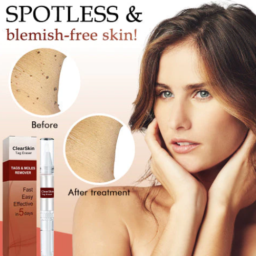 ClearSkin Tag Eraser
