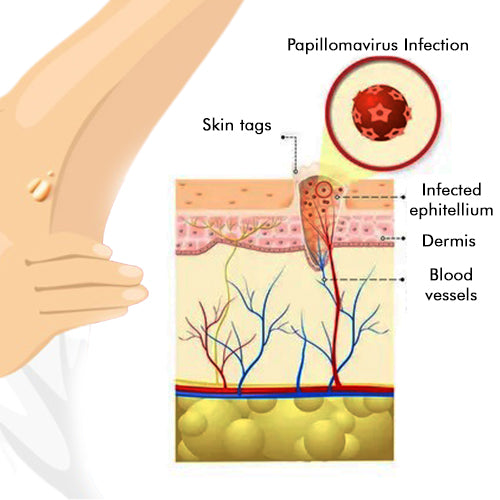 ClearSkin Tag Eraser
