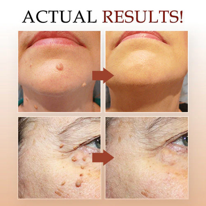 ClearSkin Tag Eraser